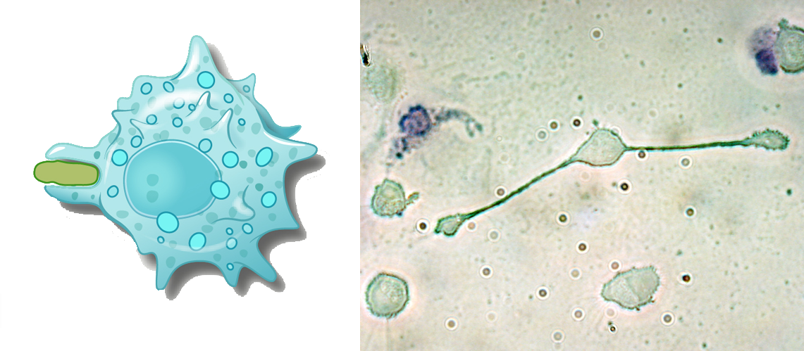 Esquema de um macrófago fagocitando uma bactéria (esquerda), e em microscopia óptica com a expansão de pseudópodes (direita).