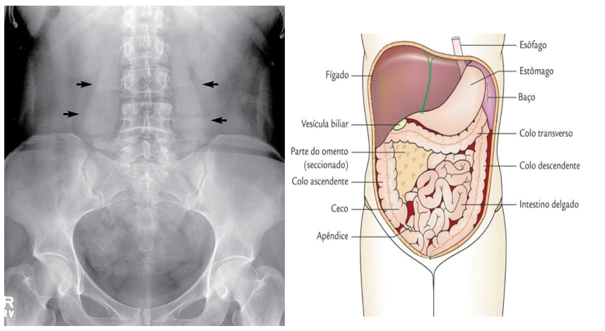 Exercícios - Anatomia Seccional e por Imagens - Órgãos e Estruturas do  Abdome e Pelve