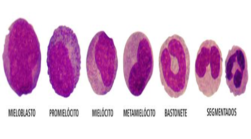 mieloblasto vs promielócito